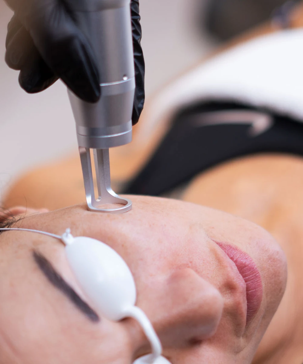 rajeunissement picolaser