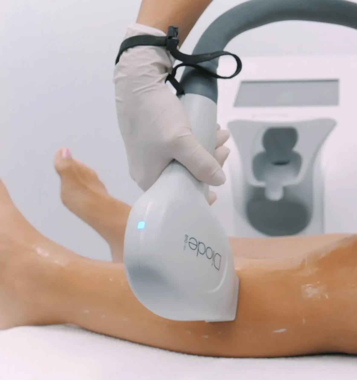 epilation laser epilation laser